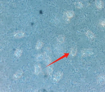 cell culture cell culture