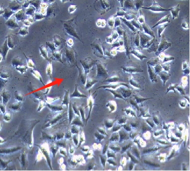 cell culture cell culture