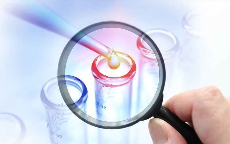 Domestic water testing